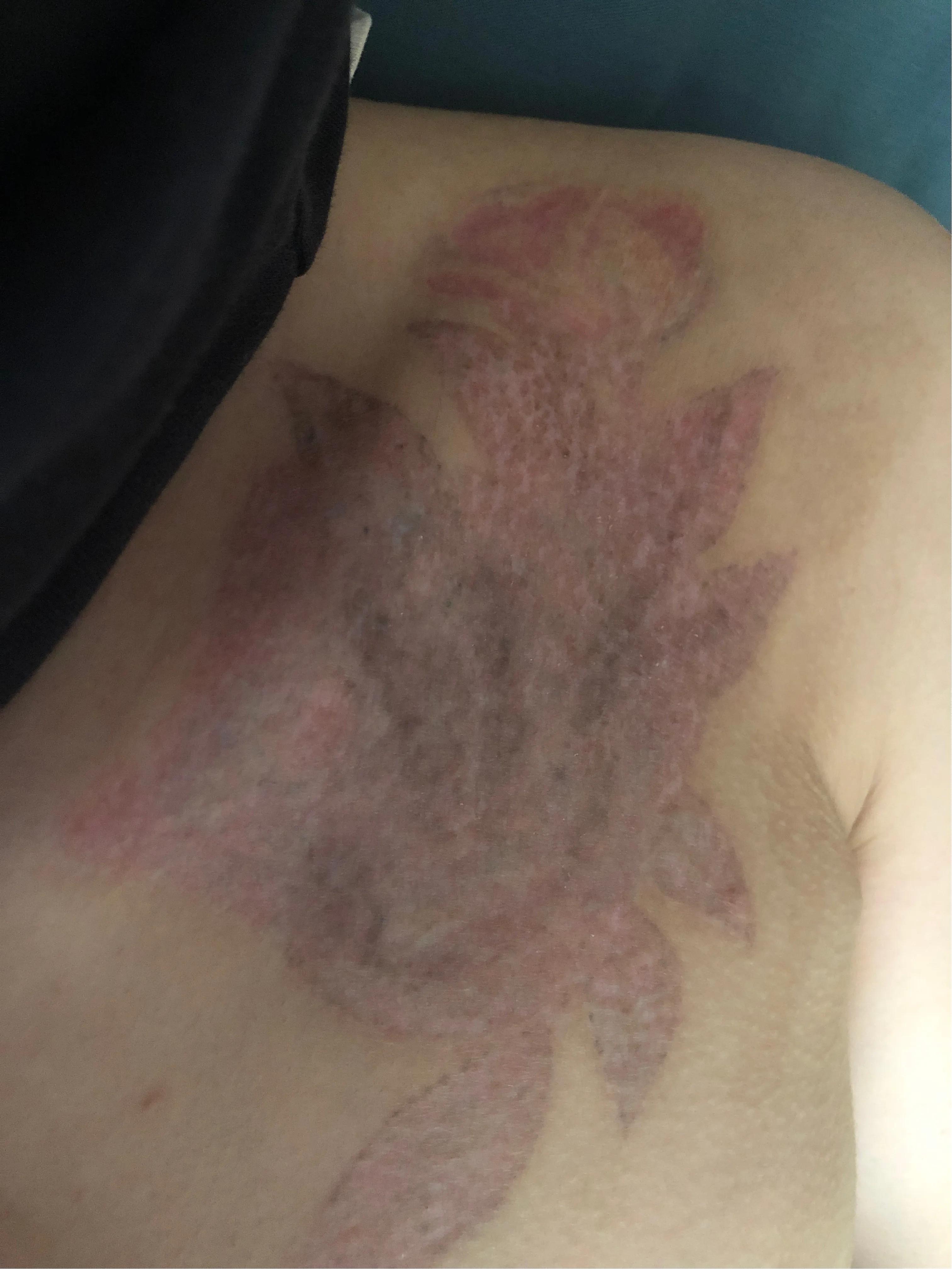 洗文身到底能不能洗干净？