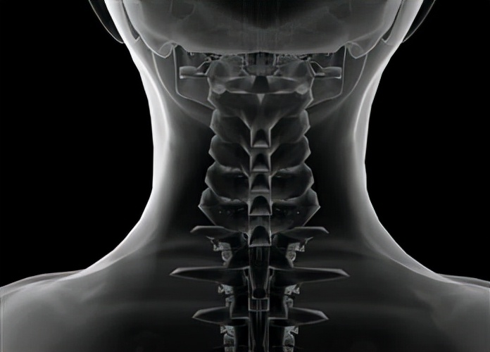 颈椎引起的头晕怎么办最有效方法,颈椎引起头晕吃什么药好得快