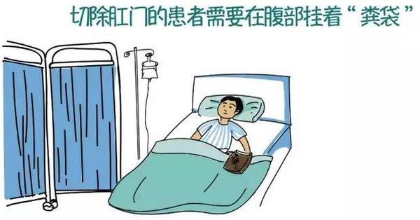 保肛手术适合早期的直肠癌患者么,直肠癌手术什么情况可保肛