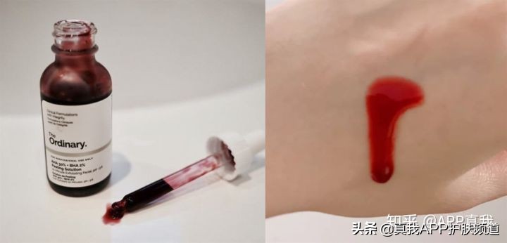 维a酸药膏治疗痘痘效果,中成药维a酸类口服药有哪些