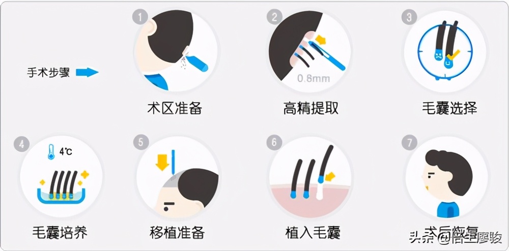 发际线突然秃了一块怎么扎马尾,女生发际线秃了吃什么