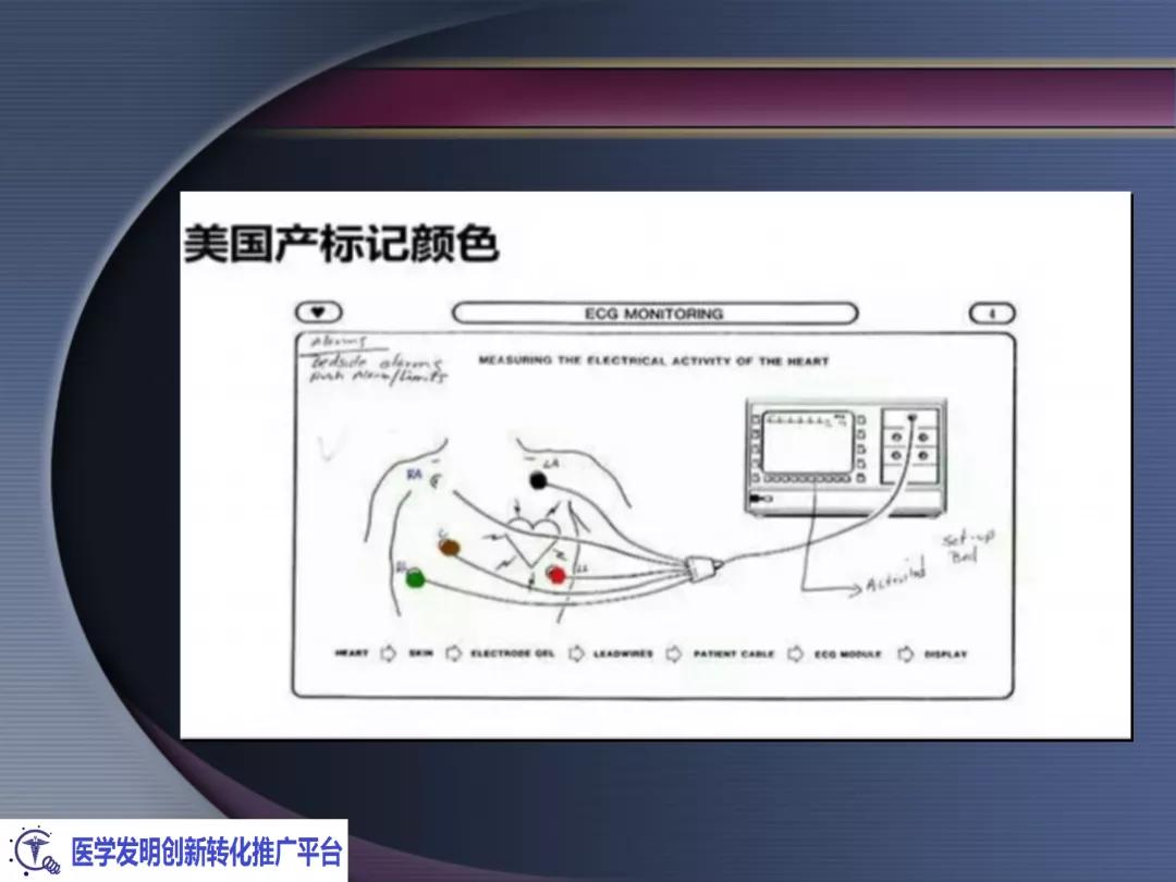 麻醉手术常见心律失常处理,麻醉引起心脏骤停原因