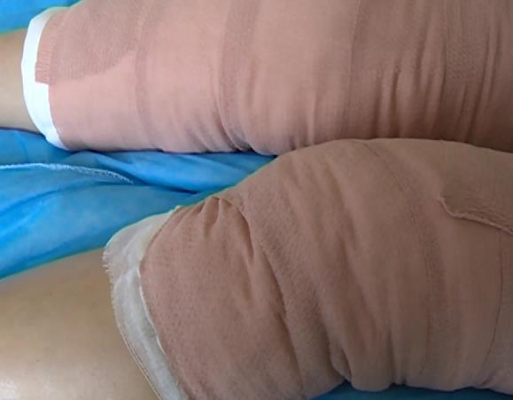 宿迁两女用“偏方”治病差点变成残疾