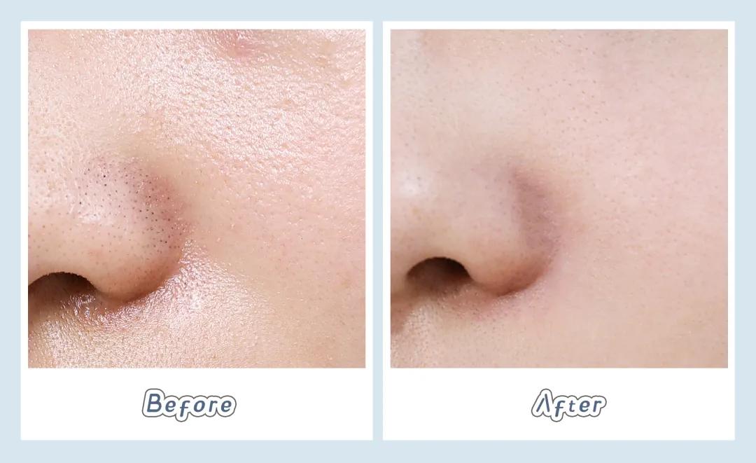 homefacialpro清洁面膜,6款超火清洁面膜测评