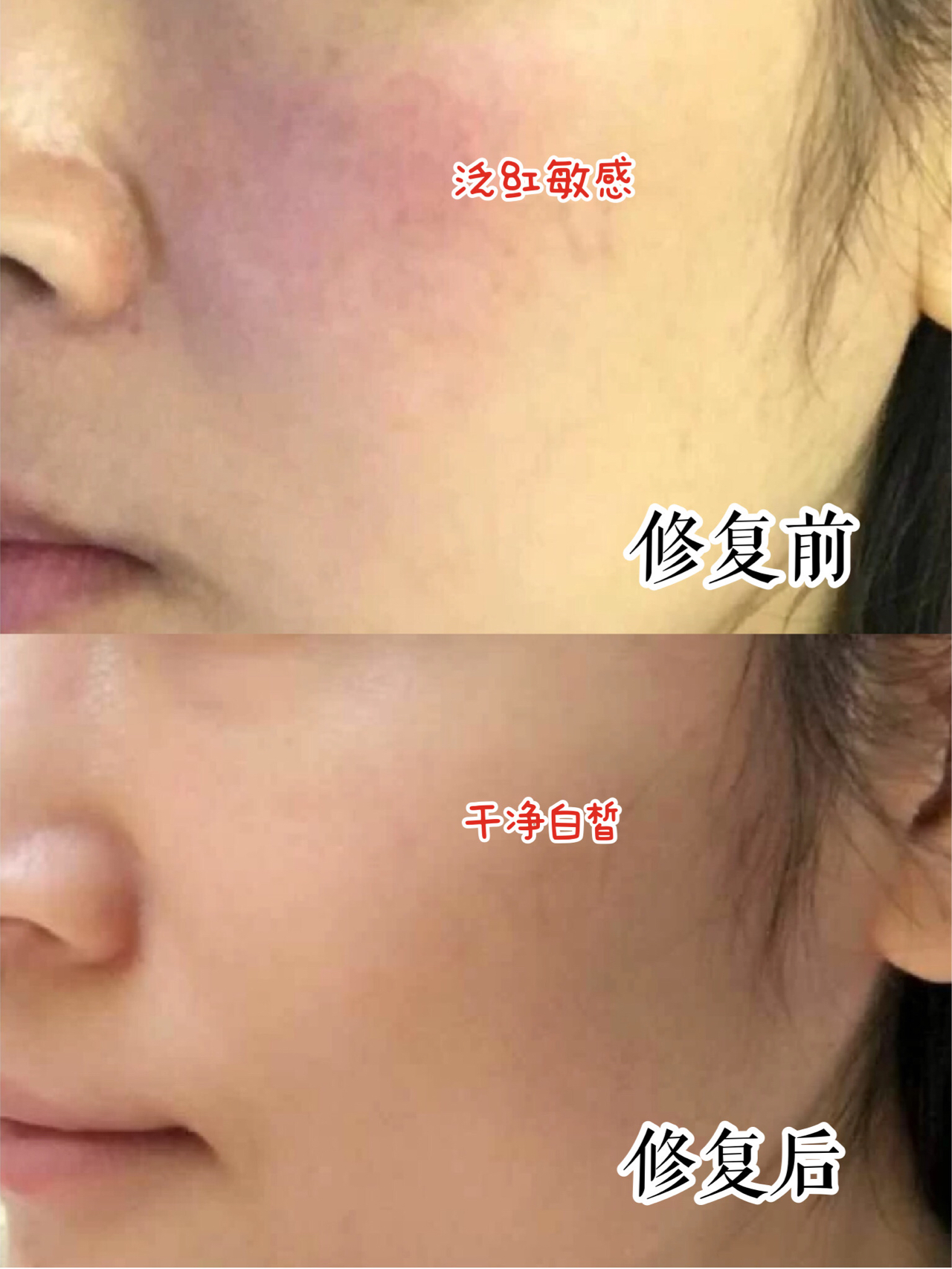 敏感肌修复小技巧,敏感肌修护最全攻略