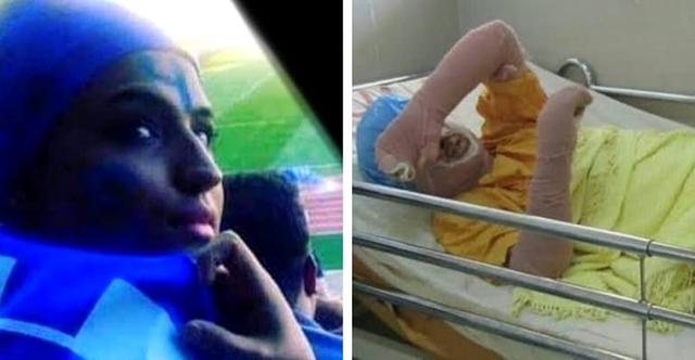 伊朗女子扮男装看球赛要被判刑，她选择穿球衣*焚自**表抗议