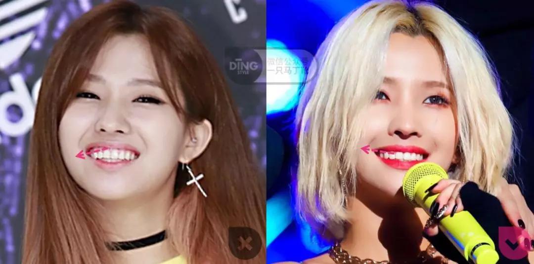 凸嘴微笑练习方法表情管理,前凸嘴怎么做表情管理