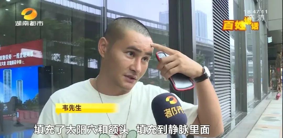 长沙29岁小伙接受5项整形，术后头皮坏死致大面积脱发！《民法典》侵权责任编：须告知医疗风险并征得同意