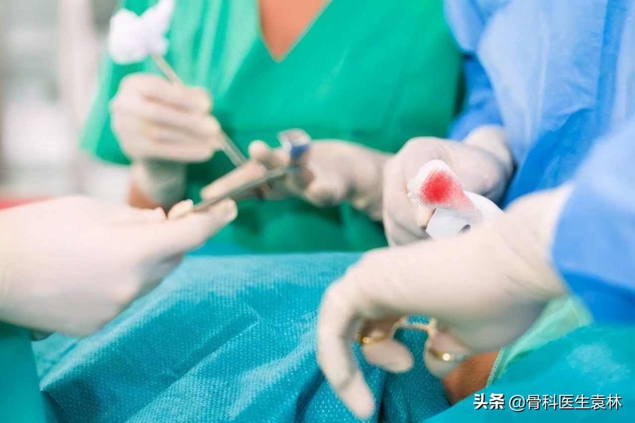 骨质增生膝盖疼怎么治,骨质增生膝盖痛怎么治