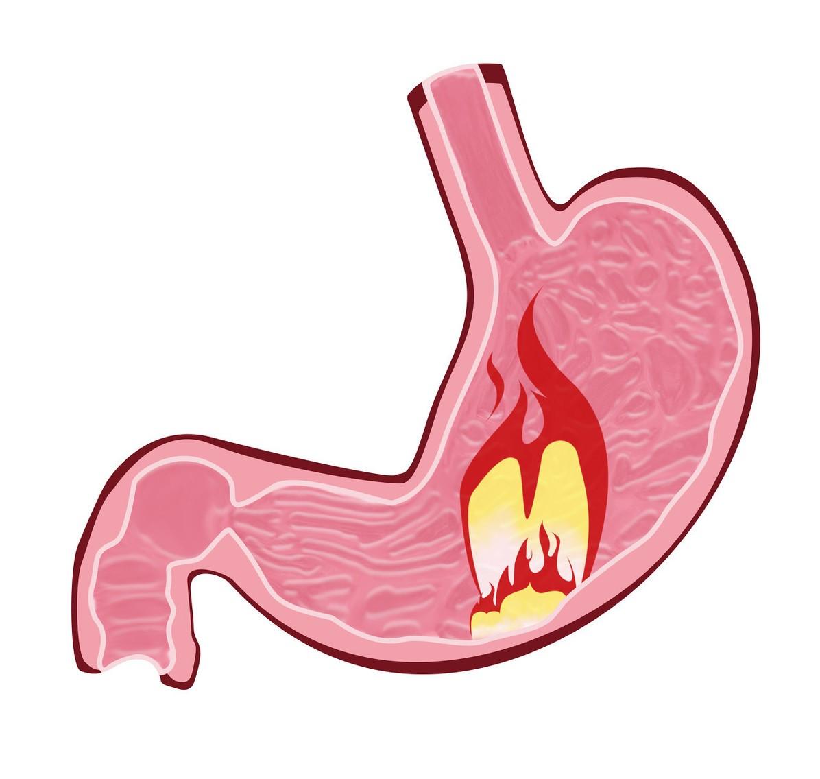 喝牛奶不好,喝牛奶可以养胃护胃吗