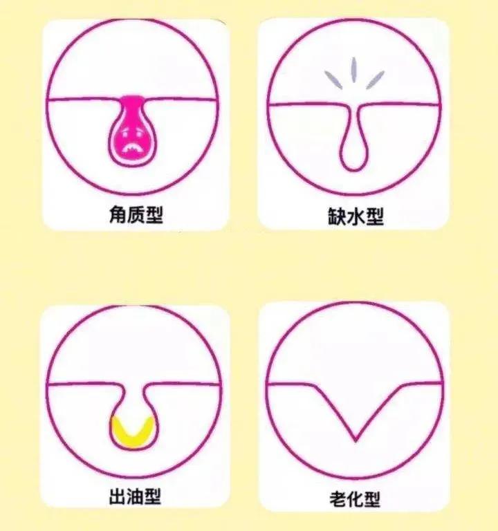 昕芙丽昕雅莎护肤品,昕芙丽和昕雅莎