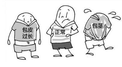 每个男生都会割包皮吗,夏天男生的包皮手术