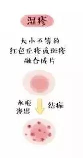 儿科医生宝宝感冒咳嗽,协和医生说小孩发烧怎么办