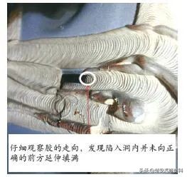 濂旈┌r鑷姩澶х伅鏃犳硶鍏抽棴,濂旈┌r澶х伅鎬庝箞鍏抽棴