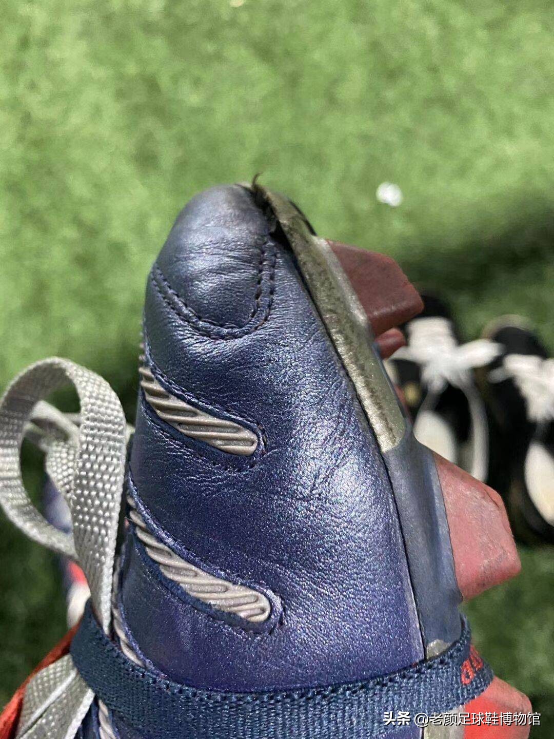 足球鞋的寿命有多长？老了以后会有哪些病？有病该怎么治疗？