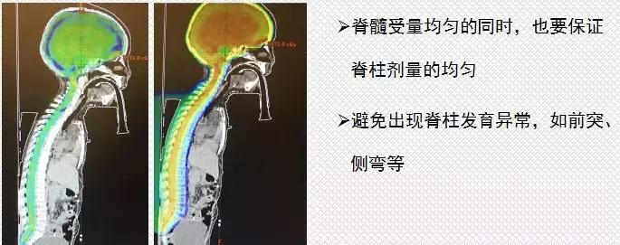 质子治癌细胞靠谱吗,质子治疗试用于什么癌