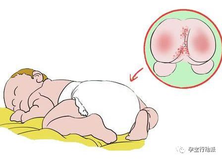 宝宝红pp是什么原因,宝宝红pp什么原因