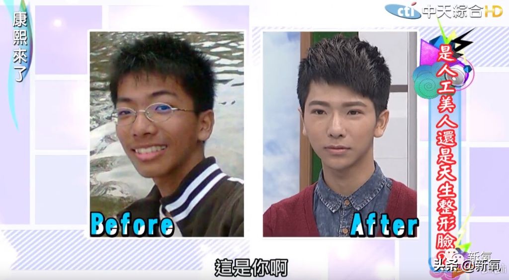 花90万从头整到脚，还可以这么自然？旁边纯天然小姐姐都看懵了