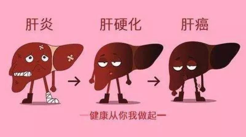 乙肝防治指南最新版,伴侣有乙肝如何防治