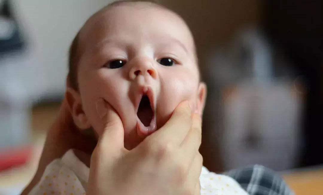 宝宝口水疹为什么会长到脸上去,婴儿口水疹用什么抹脸比较好