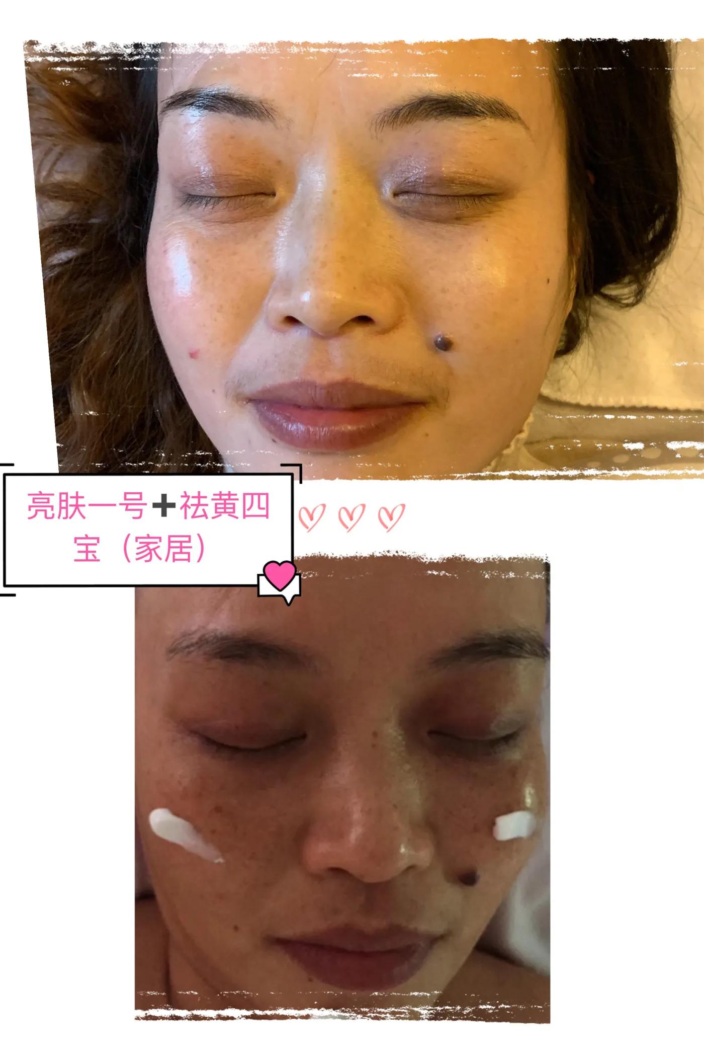 美白攻略2.0教你速成超正冷白皮,三种美白神器让你拥有无瑕雪肌