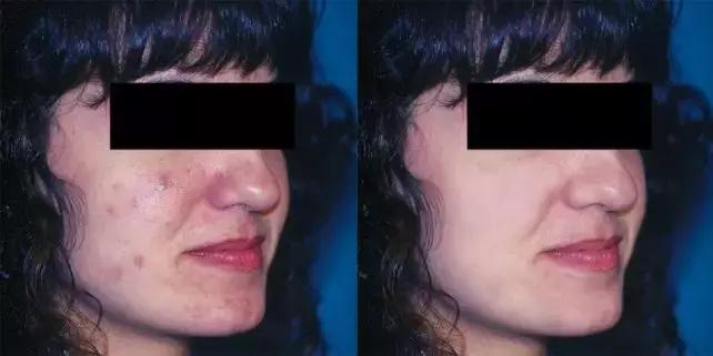 皮肤科医生告诉你如何护肤,皮肤科医生告诉你如何抗老