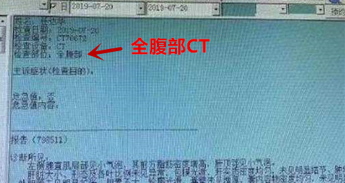 任达华手指伤重再做手术,任达华被捅伤在哪