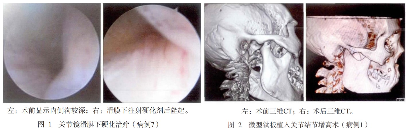 004.为什么很多人总是像王源哥哥一样掉下巴？