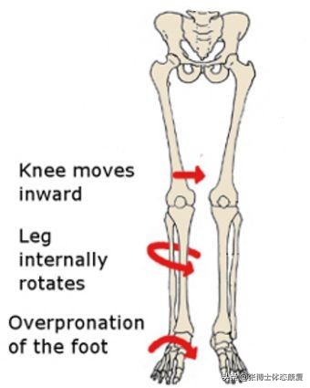 体态矫正训练o型腿扁平足,体态矫正x型腿