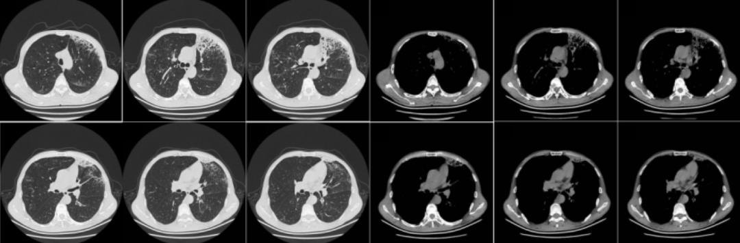 时隔一年再次住院,时隔一年旧病复发