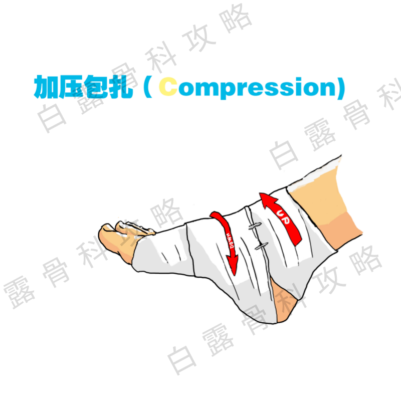 崴脚伤了脚踝怎么处理,崴到脚必须去正骨吗