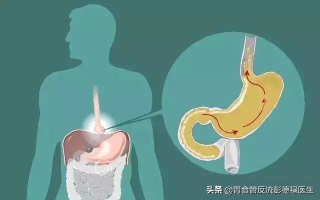 胸口半夜灼烧感疼啥原因,夜里胸口痛无法入眠怎么办