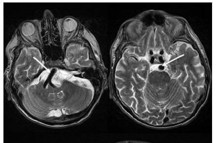 医生过度检查怎么起诉,对于医院的过度检查该怎么办