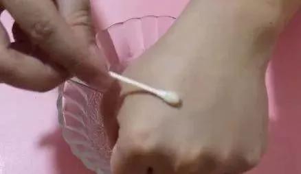 女性抹红霉素软膏的作用与功效,红霉素软膏涂脸美白