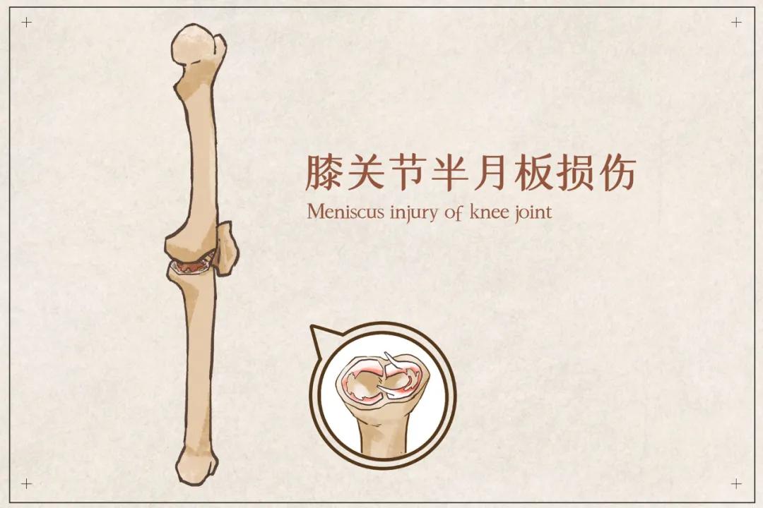 薇娅怎么住院了,薇娅手术后的状况