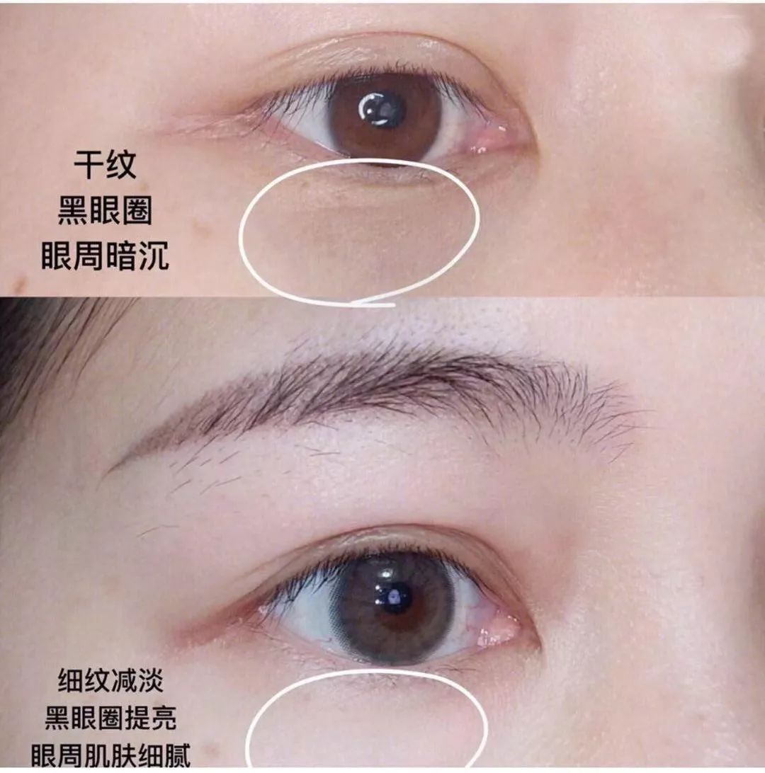 林允张韶涵面膜,林允同款眼膜推荐