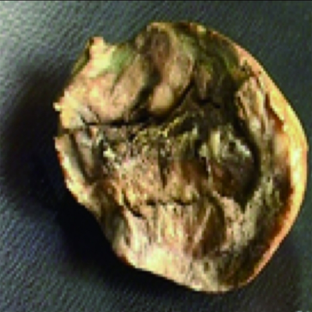 马铃薯种植面临的问题和风险,马铃薯低温种植危害