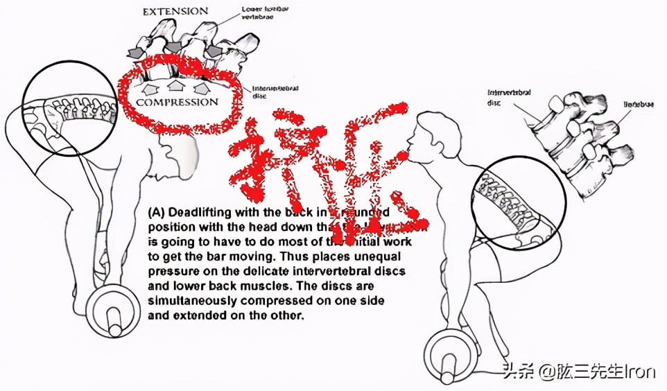 健身腰部肌肉损伤怎么恢复,健身腰肌损伤要多久才能再次运动