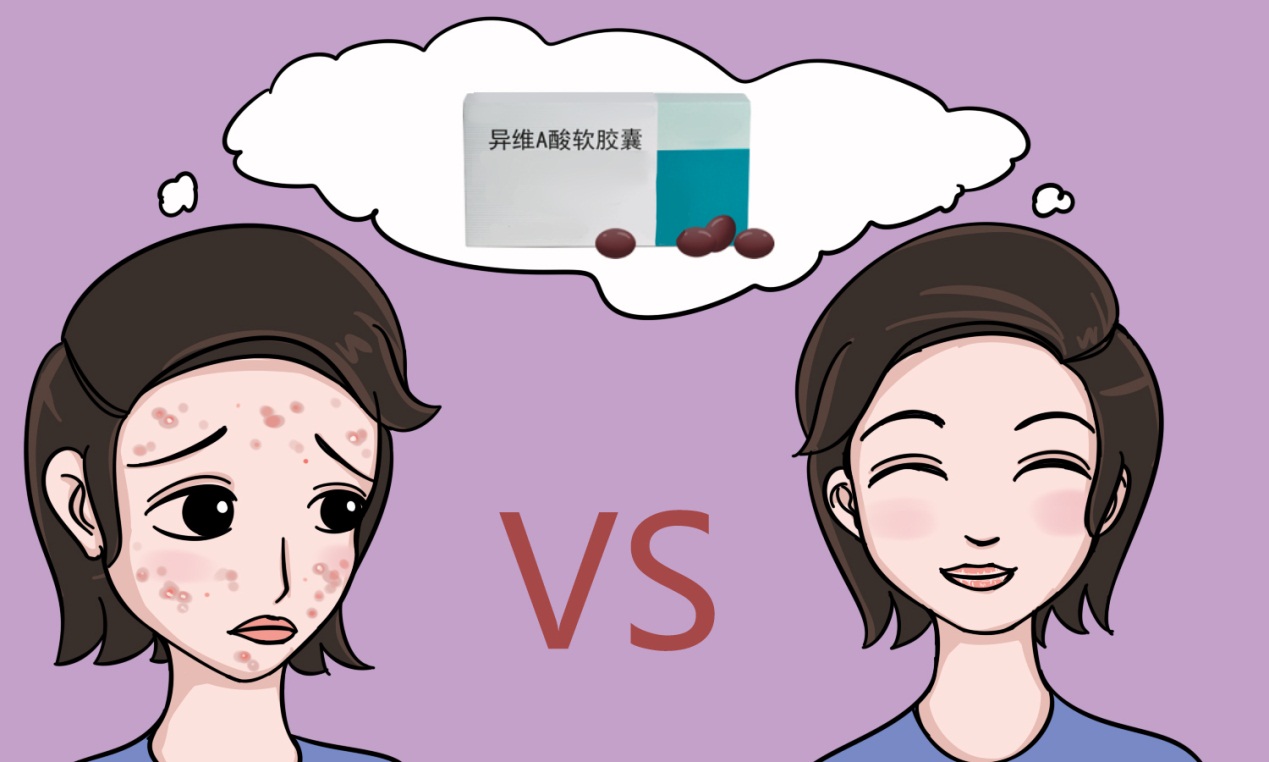 治疗痘痘到哪个医院好啊,怎么治疗痘痘最经典有效