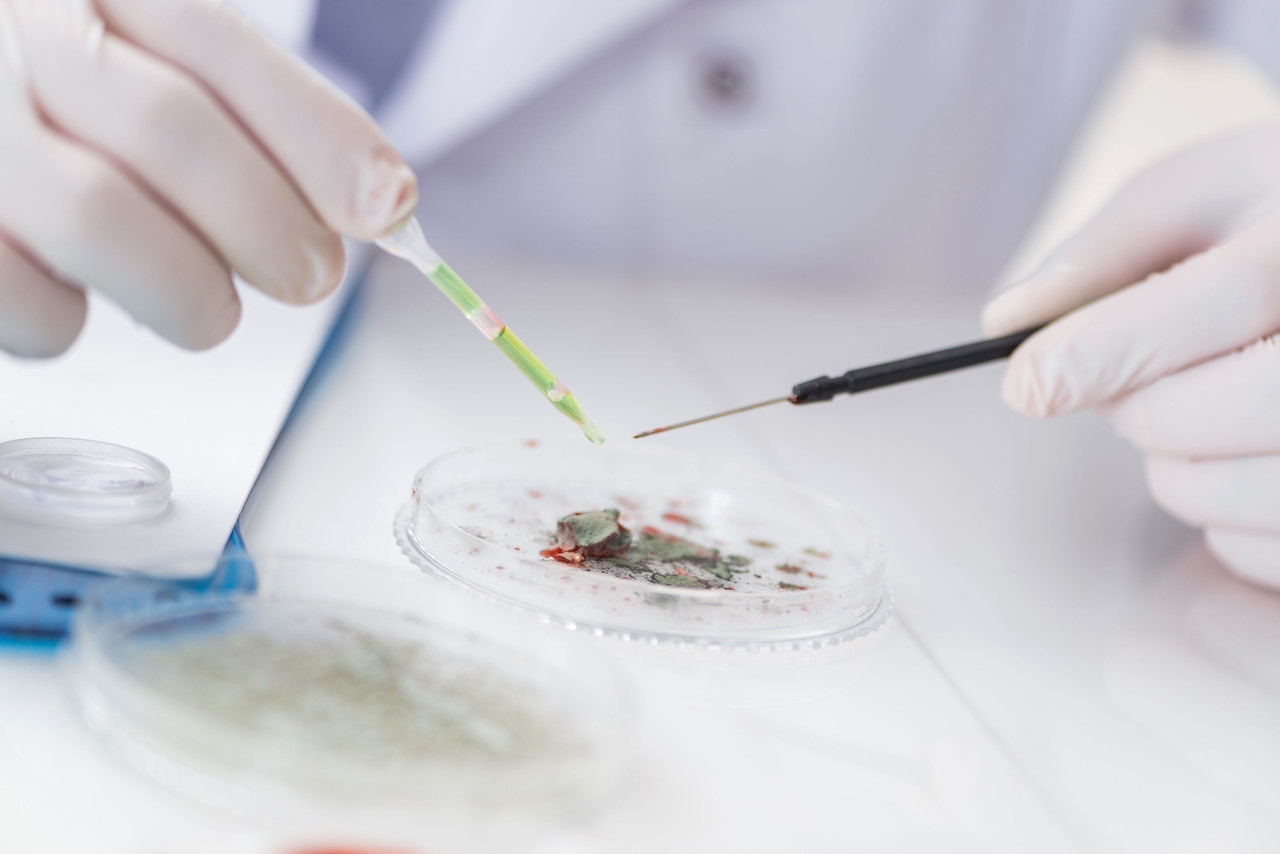 肺癌分期和治疗方案的选择