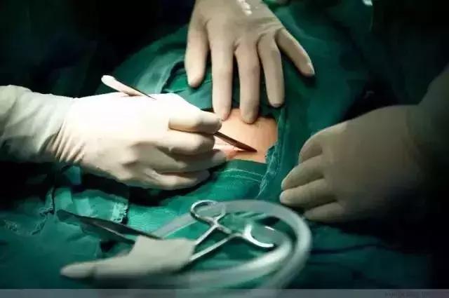 剖腹产术后4小时恢复知觉正常吗,剖腹产术后咳嗽怎样快速恢复