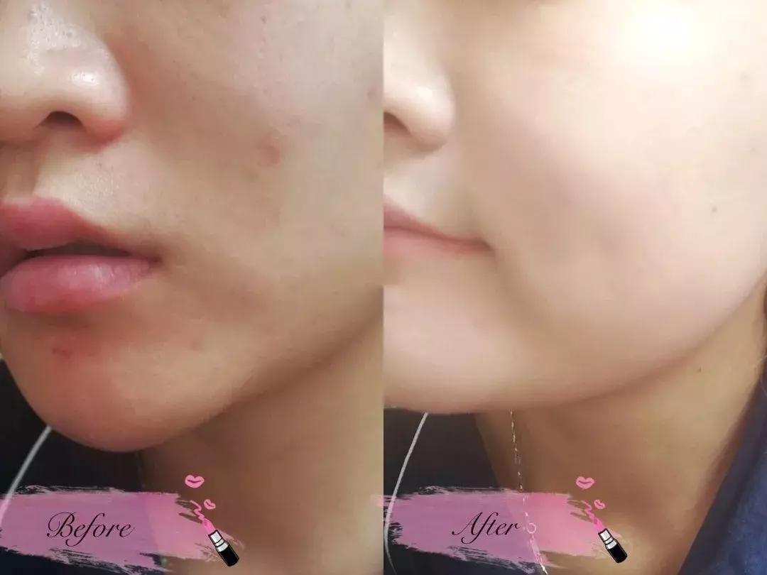 蜜丝佛陀烟酰胺粉底液45号,蜜丝佛陀烟酰胺养肤粉底液测评