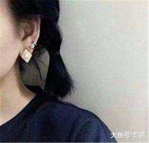 女孩突发怪病脸部疯狂生长,女孩患病满脸毛发