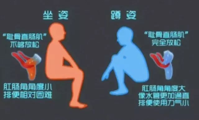 深蹲做不下去怎么办,深蹲蹲不下去练什么动作