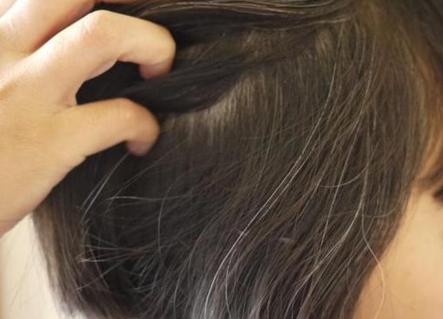 “气血不足”的人容易白发丛生?这5种食物或可“补气养血”