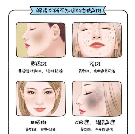祛斑难？试试这样做！