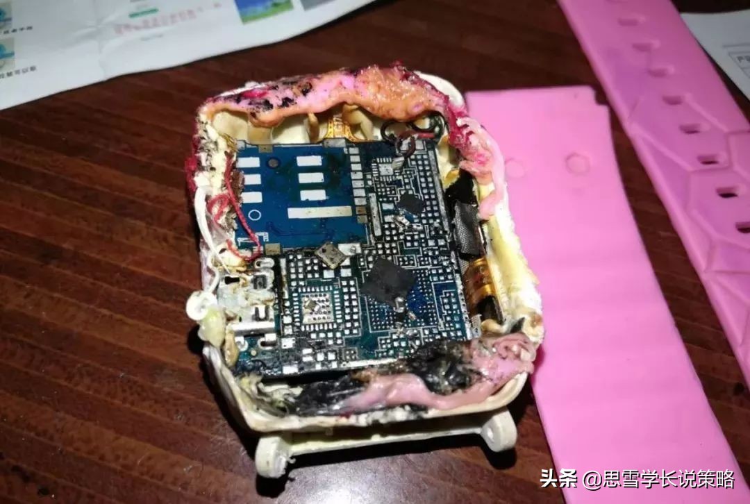 手表自燃4岁女孩被烧伤,电话手表着火三岁小孩被烧伤视频