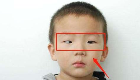 儿童玩手机黑眼珠消失视频,男孩玩手机出现黑眼圈