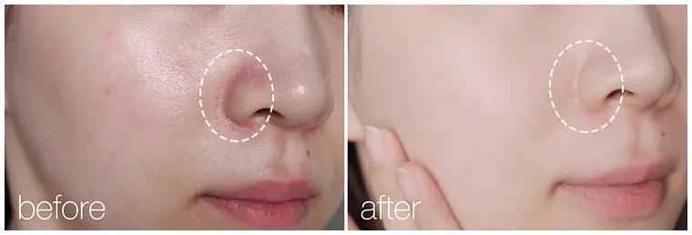 绵羊油适合的肤质,倾慕小铺澳洲绵羊油水润滋养