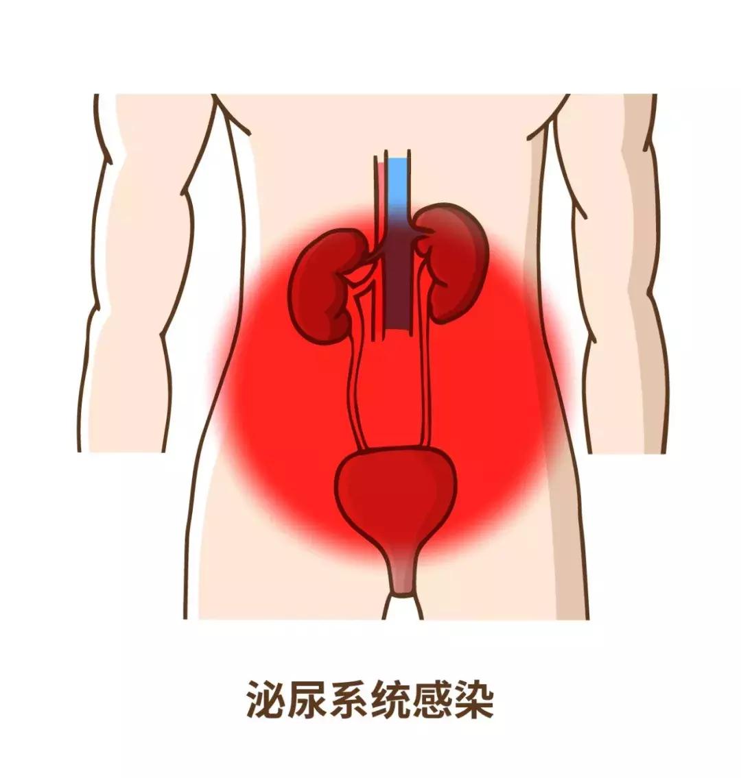 摔跤会死人吗,老年人为什么摔跤致命